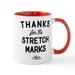 CafePress - Stretch Marks Mug - 11 oz Ceramic Mug - Novelty Coffee Tea Cup