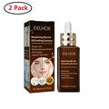 2 Pack Acne Treatment Serum Tea Tree Acne Treatment Cystic Acne Treatment Clear Skin Serum Acne Products