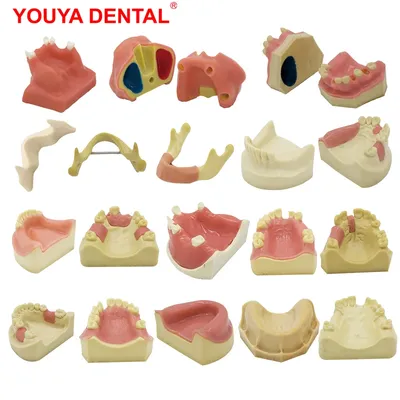 YOUYA-Modèle dentaire pour la pratique de l'implant dentaire affichage de la formation dentaire