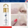 Fairking – sérum d'escargot pour le visage Essence hyaluronique acide hyaluronique blanchissant