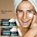 Moisture Cream - Non-Irritating - Fade Blemish - Gentle - Vitamin E Men Face Cream - for Home - 30g/50g