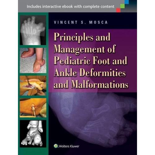 Principles and Management of Pediatric Foot and Ankle Deformities and Malformations – Vincent S. Mosca