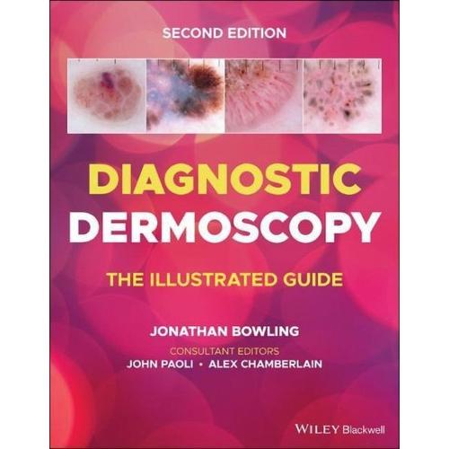 Diagnostic Dermoscopy – Diagnostic Dermoscopy