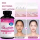 Collagen vitamins and biotin nutritional supplements for healthy skin skin elasticity and healthy