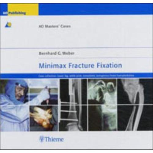 Minimax Fracture Fixation – Bernhard G. Weber