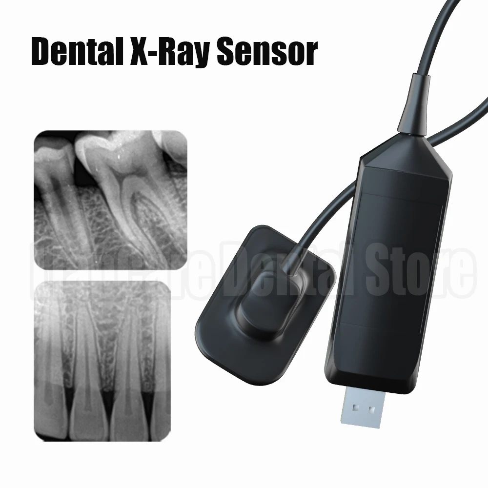 Sensore dentale medico sensore a raggi X DynImage sistema intraorale digitale a trasmissione rapida cavo intraorale Include Software 3m