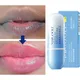 Remove Dark Lip Balm Whitening Moisturizing Cream Hyaluronic Acid Exfoliating Dead Skin Lightening