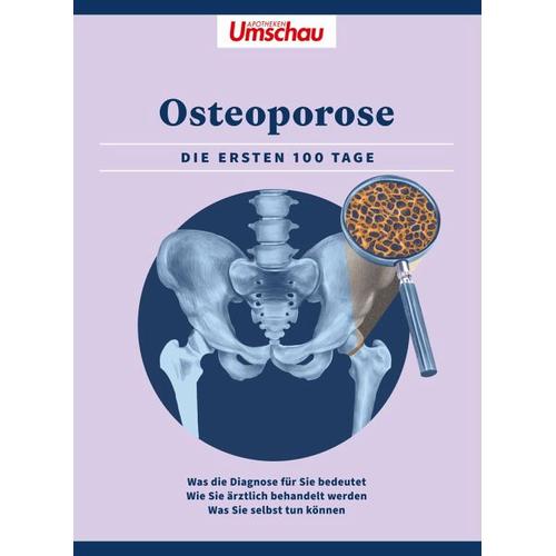 Apotheken Umschau: Osteoporose – Herausgegeben:Wort & Bild Verlag