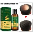 Hair Care Hair Growth Essential Oils Essence Original Authentic 100% Hair Loss Liquid Health Care