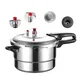 Gas Induction Cooker Universal Pressure Cooker Home Kitchen Cooking With Explosion-proof Pressure