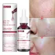 30ml Salicylic Fruit Acid Essence Pore Shrinking Serum Smooth Pores Anti Aging Bghten Whitening