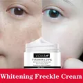 Crème blanchissante pour le visage élimine les taches de rousseur déformable pour le bain