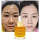 Collagen Anti Wrinkle Serum Boost Matrixyl 3000 -97% Erase Deep Wrinkles And Dark Spots Whitening