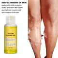 Yellow Peeling Oil Dark Skin Bleaching Remove Arm Knee Legs Melanin Body Brighten Scrub Exfoliating