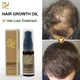 PURC-Huile de Croissance Capillaire Anti-chute de Cheveux Remède contre la Calvitie Boost de