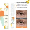 Turmeric Eye Cream Eye Wrinkle Repair Dark Circle Eye Cream Eye Cream For Dark Circle And Puffiness Eye Cream Dark Circle