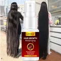 Potente Spray per la crescita dei capelli essenza per il trattamento anticaduta dei capelli previene