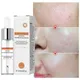 Pore Shrinking Serum Face Removing Large Pores Tightening Repairing Facial Pore Minimizing Essence