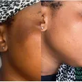 Natural Skin Lightening Soap Herbal Skin Brightening Age Spots Dark Spot Pore Shrinking Dark