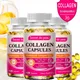 Hydrolyzed Collagen Capsule Skin Brightening&Joint&Hair&Nails Skin Health Care Collagen Nutritional