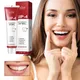 Probiotic Caries Toothpaste SP4 Whitening Repair Tooth Remover Paste Oral Fresh Teeth Plaque Cleaner