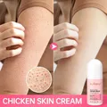 Chicken Remover Skin Care Body Cream Keratosis Pilaris Treatment Skin Repair Cream Body Lotion