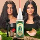 Ayurvedic Hair Growth Oil India Adivasi Organic Hair Growth Serum Anti Hair Loss Fast Regrowth