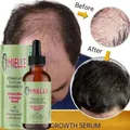 Hair Growth Essential Oil 100% Mint Rosemary Strengthening Nourish Treatment Split End Dry Hair