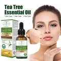 Anti Acne Whitening Facial Serum Tea Tree Oil Control Pores Shrinking Acne Scar Removal Essence