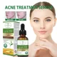 Anti Acne Whitening Facial Serum Tea Tree Oil Control Pores Shrinking Acne Scar Removal Essence