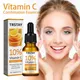 Vitamin C Whitening Facial Essence Hyaluronic Acid Lightens Black Spots Age Spots Sunburn