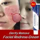 Repair Facial Redness Cream Effective Soothing Sensitive Skin Fast Treatment Redness Rosacea Itching