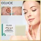 Eelhoe Silk Protein Skin Repair Soap Facial Cleaning Soap Remove Mites Blackheads Natural Goat Milk