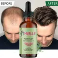 Mielle Rosemary Mint Hair Oil For Scalp&Hair Strengthening Nourish Improve Split Ends Soothe Dry
