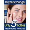 Dark Spot Remover for Face Removing Freckle Chloasma Senile Plaques Sunburn Cyasma Chorioplaque