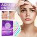 Kehuo Holographic Acnes Patch with Salicylic and TeaTree Oil Facial Acnes Patch 180 Piece of Acnes Patch Water Colloidal Acnes Patch Beauty & Personal Care