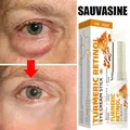 Instant Eye Bags Remove Eye Cream Anti Fat Particles Dark Circles Under-Eye Puffiness Firming