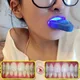 1pc Dental Zähne Bleaching Licht LED Bleichen Zähne Accelerator Für Aufhellung Zahn Kosmetische