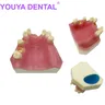 Übungs modell für die Implantation der Kiefer höhle mit fehlendem Zahn Zahn implantat zahn modell