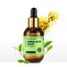 RoseHome Acne Treatment Serum Strengthen Tea Tree Acne Treatment Cystic Acne Treatment Clear for Clearing Severe Acne Blemish Pimple