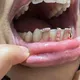 RACHELZ Hip Hop Single Pink Green Zircon Vertical Row Teeth Grill 14K Gold Plated Crystal Tooth Caps