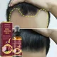 Powerful Hair Growth Serum Spray Anti Hairs Loss Treatment Essence Repair Nourish Roots Regrowth