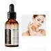 XEOVHV Vitamin C Vitamin E Facial Serum Anti Aging Facial Super Vit C Serum with Hyaluronic Acid & Vitamin E for Dark Spots Skin Care Christmas Gift & Stocking Stuffers 30ml 1 Fl. Oz