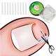 10pcs Ingrown Toenail Correction Tool Ingrown Toe Nail Treatment Elastic Patch Sticker Straightening Clip Brace Pedicure Tool