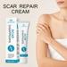Scar Removal Cream Repair Stretch Marks Burn Acne Surgical Acne Scar Ointment Herbal Treatment Gel Whitening Beauty