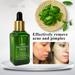 ELES Acne Treatment Green Tea Essence Anti-acne Essence Mild And Non-irritating Anti-acne Anti-acne Print Essence