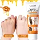 Fast Whitening Dark Knuckles Products Intense Stains Remover Anti Cracking Serum Cream Pigmentation