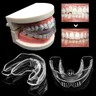 1PC apparecchi ortodontici apparecchio apparecchi dentali Anti bruxismo bellezza orale assistenza