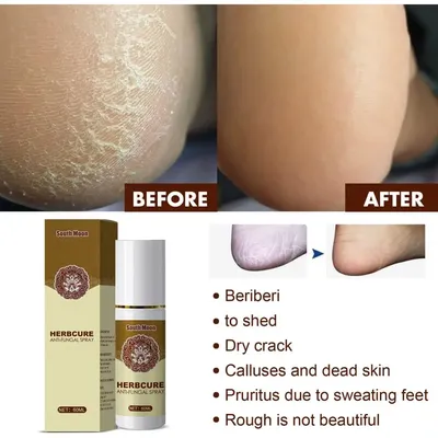 Schnelle Wirkung 60ml nützliches Peeling Fuß peeling Spray schnelle Absorption Fuß deodorant sanft