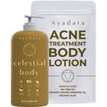 AYADARA Acne Treatment Body Lotion 8 oz Tea Tree Oil for Skin Back and Body Acne Treatment Lotion Back Acne Treatment Cream for Women and Men Acne Lotion for Body Pimple Cream 75-Day Supply